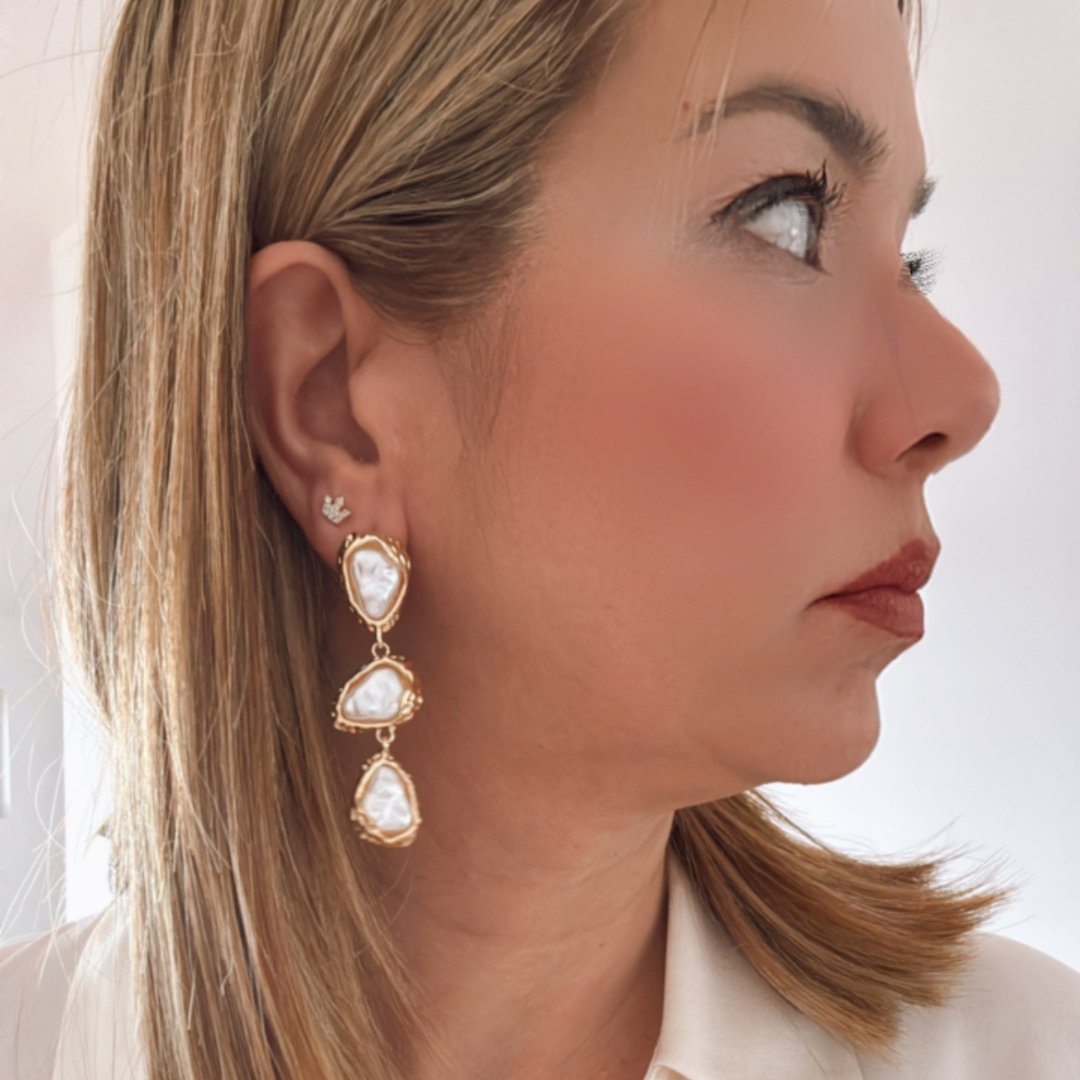 ARETES