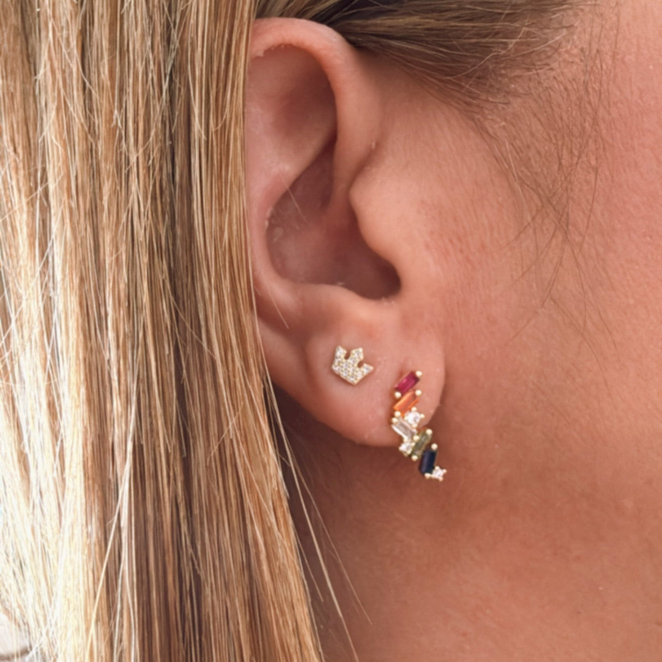 Aretes Radia